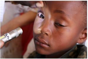 Augenuntersuchung in Malawi